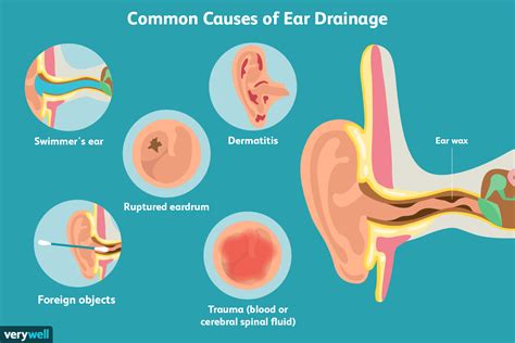 ear leaking clear fluid no pain|Ear Discharge: Causes, Diagnosis, and Treatment